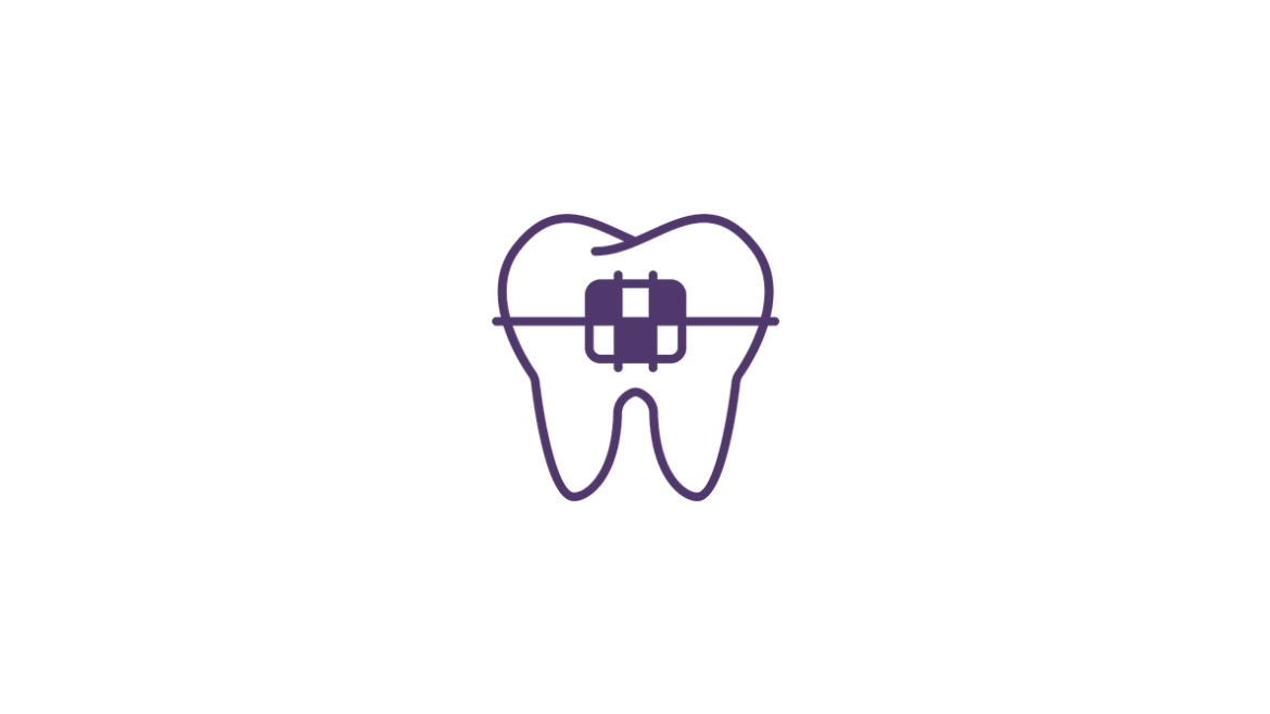 Ortodontska terapija fiksnim aparatićem