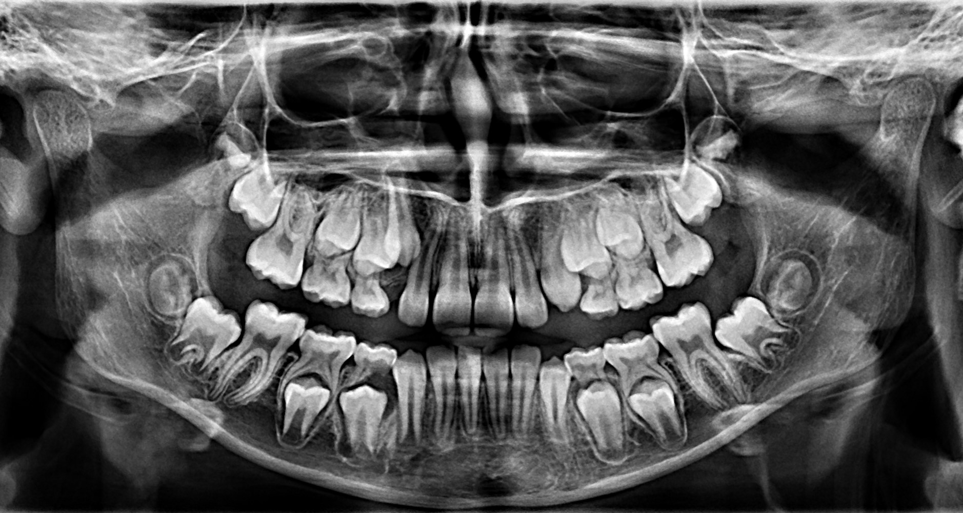 Rendgensko snimanje u ortodonciji – sve što trebate znati